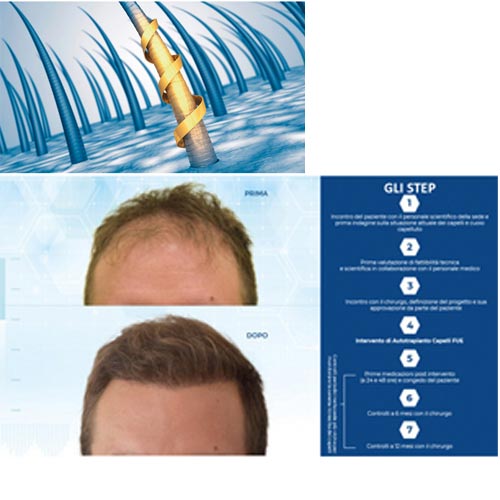 ISTITUTO HELVETICO SANDERS - ISTITUTO HELVETICO SANDERS